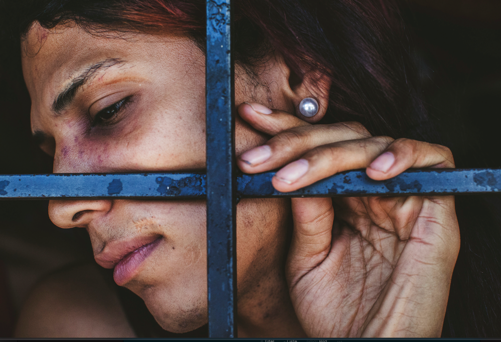 Poli-Valencia, Venezuela – Jänner, 2017. Eine Transgender-Frau zeigt ihre Verletzungen und Narben hinter ihren Zellengittern. Die Missachtung der Genderidentität durch das Gefängnissystem führt dazu, dass Transgender-Insassen in unangemessenen Zellen untergebracht werden, wodurch ein gefährliches Umfeld entsteht. Hier sind Transfrauen häufig der Gefahr sexueller Übergriffe und Vergewaltigungen durch männliche Inhaftierte ausgesetzt. Ungleichheit verringern